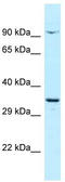 CTNNBL1 antibody, TA343200, Origene, Western Blot image 