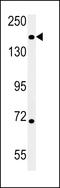 DIS3 Like Exosome 3'-5' Exoribonuclease antibody, LS-C167411, Lifespan Biosciences, Western Blot image 