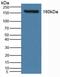 Solute Carrier Family 12 Member 3 antibody, LS-C314979, Lifespan Biosciences, Western Blot image 