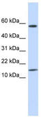 Keratin Associated Protein 11-1 antibody, TA338959, Origene, Western Blot image 