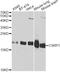 Cysteine And Glycine Rich Protein 1 antibody, A1071, ABclonal Technology, Western Blot image 