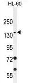 Sperm Antigen With Calponin Homology And Coiled-Coil Domains 1 antibody, LS-C161441, Lifespan Biosciences, Western Blot image 