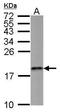 Ubiquitin Conjugating Enzyme E2 V2 antibody, GTX117707, GeneTex, Western Blot image 