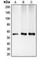 Checkpoint Kinase 1 antibody, LS-C352014, Lifespan Biosciences, Western Blot image 