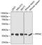 Protein Phosphatase 4 Catalytic Subunit antibody, GTX65836, GeneTex, Western Blot image 
