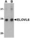 Elongation of very long chain fatty acids protein 6 antibody, TA306564, Origene, Western Blot image 