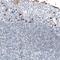 Apolipoprotein B MRNA Editing Enzyme Catalytic Subunit 3A antibody, NBP1-88999, Novus Biologicals, Immunohistochemistry paraffin image 