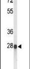 Abhydrolase Domain Containing 11 antibody, PA5-26427, Invitrogen Antibodies, Western Blot image 