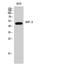 Interferon Regulatory Factor 3 antibody, STJ93762, St John