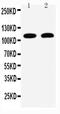 Desmoglein 3 antibody, PA5-79172, Invitrogen Antibodies, Western Blot image 