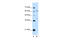 Interferon Lambda Receptor 1 antibody, 30-351, ProSci, Western Blot image 