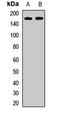 Kinectin 1 antibody, LS-C668171, Lifespan Biosciences, Western Blot image 