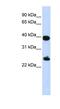 H2A Histone Family Member Y antibody, NBP1-53002, Novus Biologicals, Western Blot image 
