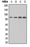 Inhibitor Of Nuclear Factor Kappa B Kinase Subunit Beta antibody, LS-C359032, Lifespan Biosciences, Western Blot image 