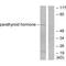 Parathyroid Hormone antibody, A00208, Boster Biological Technology, Western Blot image 