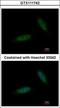 TBC1 Domain Containing Kinase antibody, GTX111742, GeneTex, Immunocytochemistry image 