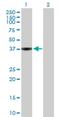 WD Repeat, Sterile Alpha Motif And U-Box Domain Containing 1 antibody, H00151525-B01P, Novus Biologicals, Western Blot image 