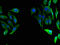 FAH antibody, A62538-100, Epigentek, Immunofluorescence image 