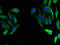 Fumarylacetoacetase antibody, A62538-100, Epigentek, Immunofluorescence image 