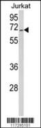 RNA Binding Motif Protein 14 antibody, 61-623, ProSci, Western Blot image 