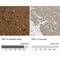 P21 (RAC1) Activated Kinase 1 antibody, NBP1-85802, Novus Biologicals, Immunohistochemistry paraffin image 