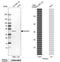 Pleckstrin Homology Like Domain Family A Member 1 antibody, NBP1-84969, Novus Biologicals, Western Blot image 