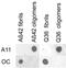 Amyloid Beta Precursor Protein antibody, OASE00468, Aviva Systems Biology, Dot Blot image 