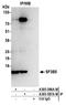 Splicing Factor 3b Subunit 5 antibody, A305-587A-M, Bethyl Labs, Immunoprecipitation image 