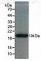 Tenascin C antibody, abx100416, Abbexa, Enzyme Linked Immunosorbent Assay image 