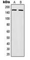 MutS Homolog 6 antibody, MBS820238, MyBioSource, Western Blot image 