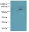 Adenosine Deaminase TRNA Specific 1 antibody, LS-C379337, Lifespan Biosciences, Western Blot image 