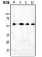 Phosphatase And Tensin Homolog antibody, LS-C761118, Lifespan Biosciences, Western Blot image 