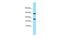 Platelet Derived Growth Factor Receptor Like antibody, A11983, Boster Biological Technology, Western Blot image 