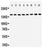 TSC Complex Subunit 1 antibody, PA5-80193, Invitrogen Antibodies, Western Blot image 