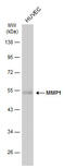 Matrix Metallopeptidase 1 antibody, GTX634538, GeneTex, Western Blot image 