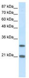 Msh Homeobox 2 antibody, TA335829, Origene, Western Blot image 