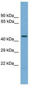 Pseudouridine Synthase 1 antibody, TA342334, Origene, Western Blot image 