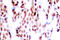 JunB Proto-Oncogene, AP-1 Transcription Factor Subunit antibody, LS-C177919, Lifespan Biosciences, Immunohistochemistry paraffin image 