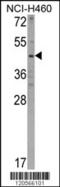 Kynureninase antibody, 62-451, ProSci, Western Blot image 