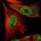 Interferon Regulatory Factor 4 antibody, NBP1-82814, Novus Biologicals, Immunocytochemistry image 