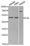 Interleukin 6 Receptor antibody, MBS128733, MyBioSource, Western Blot image 