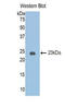 Serpin Family A Member 6 antibody, LS-C298393, Lifespan Biosciences, Western Blot image 