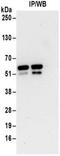 Tryptophanyl-TRNA Synthetase antibody, NBP2-32186, Novus Biologicals, Immunoprecipitation image 