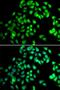 Nuclear cap-binding protein subunit 2 antibody, LS-C346336, Lifespan Biosciences, Immunofluorescence image 