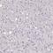 Carnosine Synthase 1 antibody, NBP2-34050, Novus Biologicals, Immunohistochemistry paraffin image 
