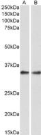 Protein Phosphatase 4 Catalytic Subunit antibody, NBP1-51947, Novus Biologicals, Western Blot image 