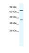 Zinc Finger Protein 660 antibody, NBP1-80190, Novus Biologicals, Western Blot image 