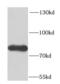 Far Upstream Element Binding Protein 1 antibody, FNab03235, FineTest, Western Blot image 