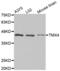 Thioredoxin Related Transmembrane Protein 4 antibody, abx002493, Abbexa, Western Blot image 