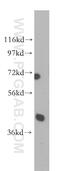 Poly(RC) Binding Protein 2 antibody, 15070-1-AP, Proteintech Group, Western Blot image 
